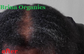 Speedy Hair Growth Tonic Spray, Saw Palmetto Berry & Sea Moss